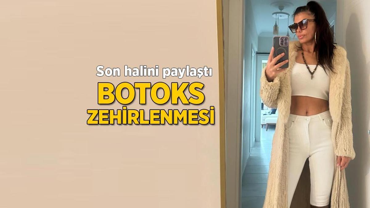 Şarkıcı Hatice’nin son hali şoke etti! ‘Botoks zehirlenmesi yaşadım’